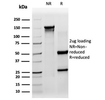 SIRT3 Antibody