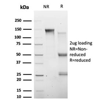 HIC2 Antibody / Hypermethylated in cancer 2 protein