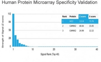 HIC2 Antibody / Hypermethylated in cancer 2 protein
