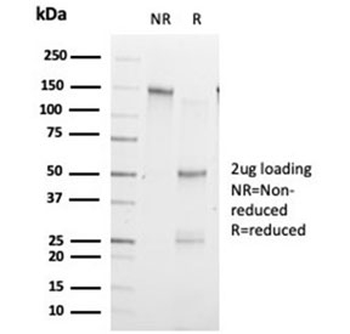 ZHX3 Antibody