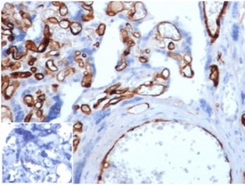 Fatty Acid Binding Protein 4 Antibody / FABP4
