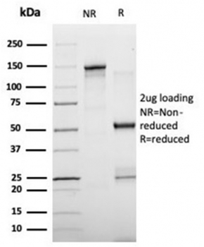 Fatty Acid Binding Protein 4 Antibody / FABP4