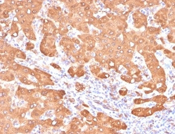 Aldehyde Dehydrogenase 1A1 Antibody / ALDH1A1
