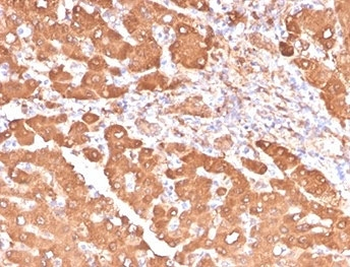 Aldehyde Dehydrogenase 1A1 Antibody / ALDH1A1