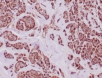 Aldehyde Dehydrogenase 1A1 Antibody / ALDH1A1