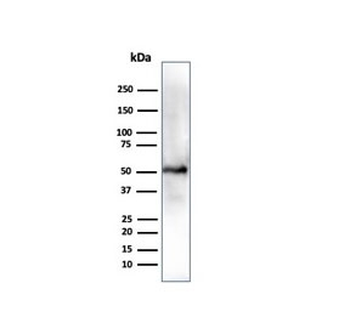 Aldehyde Dehydrogenase 1A1 Antibody / ALDH1A1