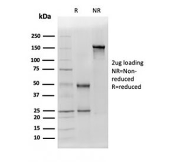 Aldehyde Dehydrogenase 1A1 Antibody / ALDH1A1