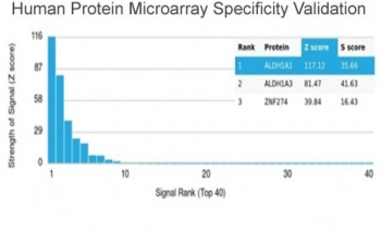 Aldehyde Dehydrogenase 1A1 Antibody / ALDH1A1