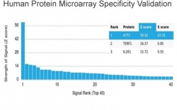 ATF2 Antibody