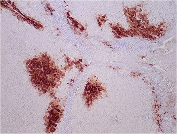 Glutamine Synthetase Antibody / GLUL