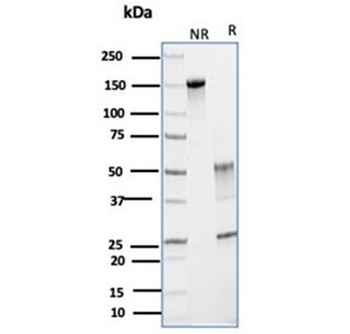 Glutamine Synthetase Antibody / GLUL