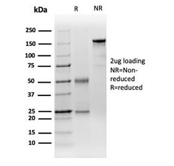 Decapping Protein 2 Antibody / DCP2 / m7GpppN-mRNA hydrolase