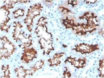 Angiotensin Converting Enzyme Antibody / ACE