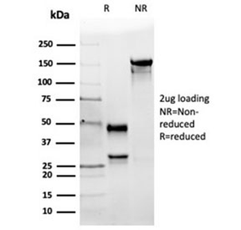 Angiotensin Converting Enzyme Antibody / ACE