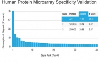Angiotensin Converting Enzyme Antibody / ACE