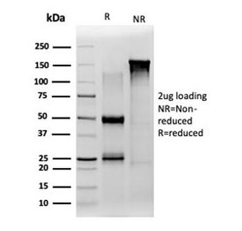 JAZF1 Antibody