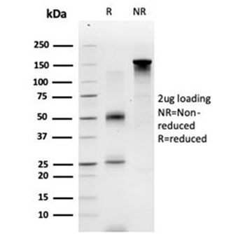 ECD Antibody / SGT1