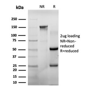 Chk2 Antibody / CHEK2