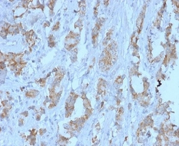 TDRKH Antibody