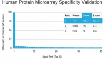 Tyrosinase Antibody