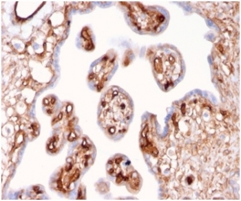 Alpha II Spectrin Antibody / SPTAN1 / Alpha Fodrin / NEAS