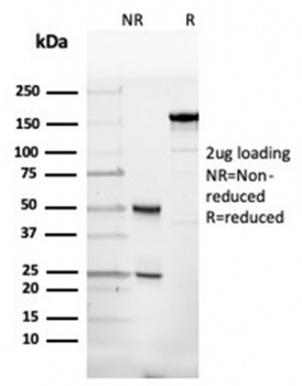 Alpha II Spectrin Antibody / SPTAN1 / Alpha Fodrin / NEAS