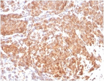 Superoxide Dismutase 1 Antibody / SOD1