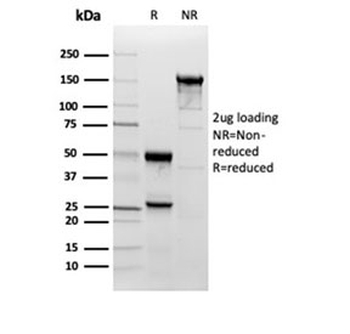 Superoxide Dismutase 1 Antibody / SOD1