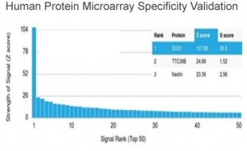 Superoxide Dismutase 1 Antibody / SOD1