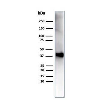 Osteonectin Antibody / SPARC