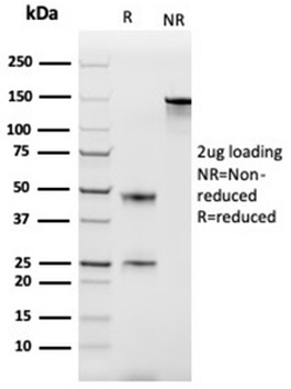 Monocyte Chemotactic Protein 2 Antibody / MCP2 / CCL8