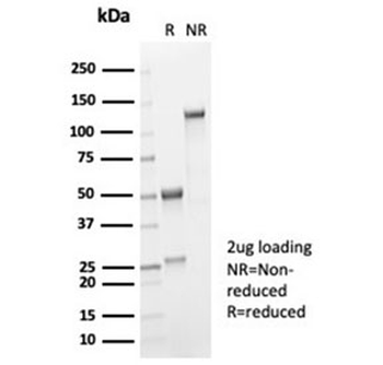 Recombinant Interleukin 2 Antibody