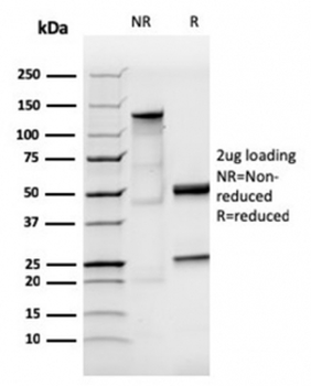Human IgA Antibody (Heavy chain)