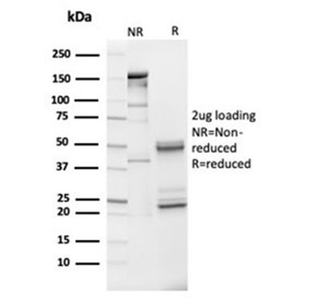 IGFBP3 Antibody