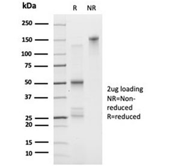 FOXL1 Antibody