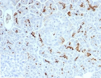 Recombinant Cystic Fibrosis Transmembrane Regulator Antibody / CFTR