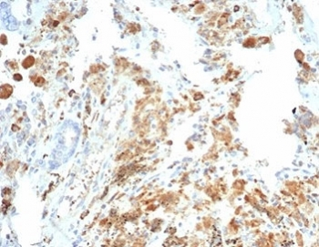 Recombinant Cystic Fibrosis Transmembrane Regulator Antibody / CFTR