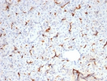 Recombinant Cystic Fibrosis Transmembrane Regulator Antibody / CFTR