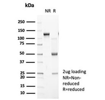 Recombinant Cadherin 2 Antibody / CDH2 / N-Cadherin