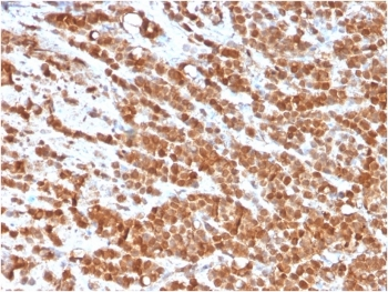 IL-2 Antibody