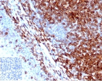 Recombinant CD43 Antibody