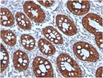 CK8 Antibody / Cytokeratin 8 / KRT8