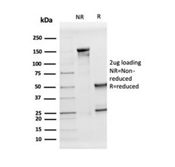 Apolipoprotein D Antibody / APOD