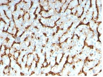Apolipoprotein D Antibody / APOD