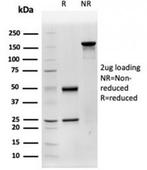 CTSD Antibody / Cathepsin D