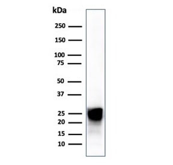 CTSD Antibody / Cathepsin D