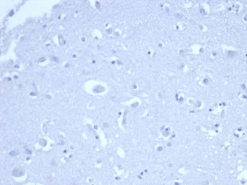 Recombinant p21WAF1 Antibody / CDKN1A