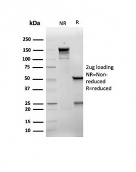 Recombinant p21WAF1 Antibody / CDKN1A