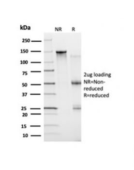 Bcl6 Antibody