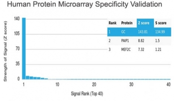 Vitamin D binding protein Antibody / VDBP / GC